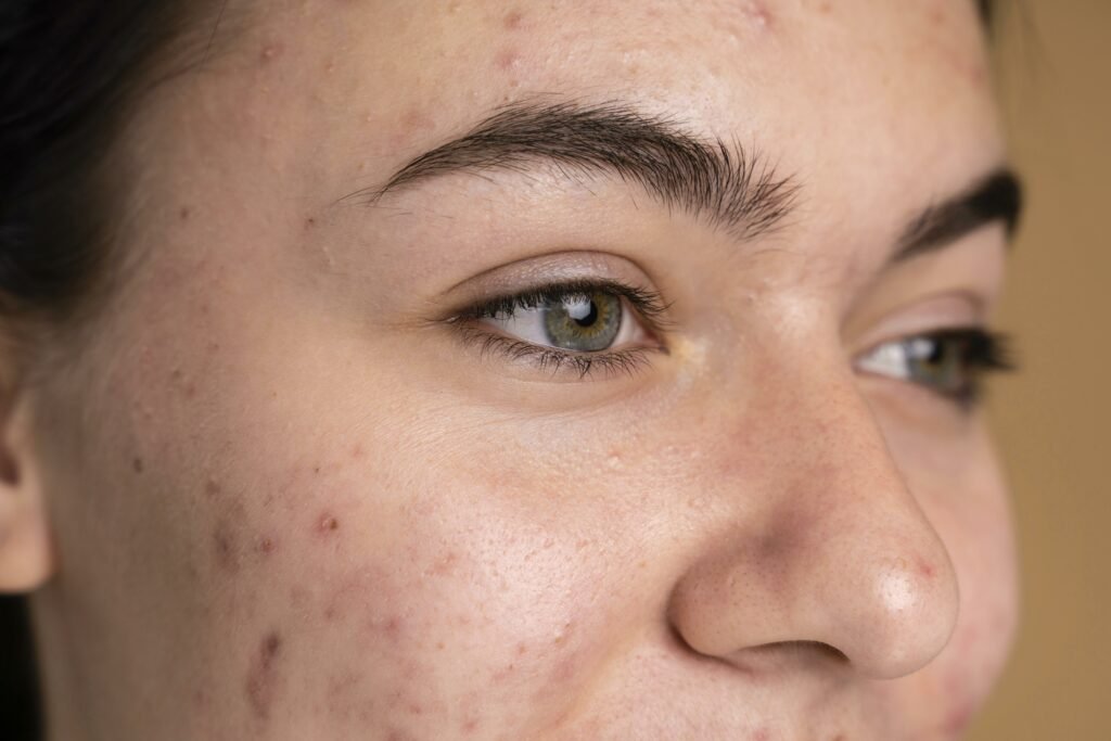 What Are the Causes of Dark Spots